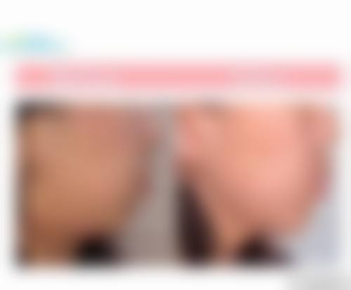 【山东威海焦蒙口腔真实口碑评价】