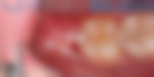 精良设备与无菌环境——保护诊疗精细与舒适