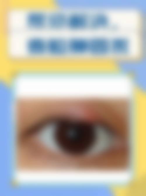 特色科室与项目:覆盖全年龄段眼健康需求