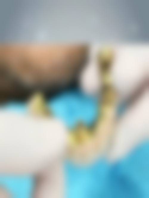 【江苏盐城张中瑶口腔门诊部常见问题解答FAQ】
