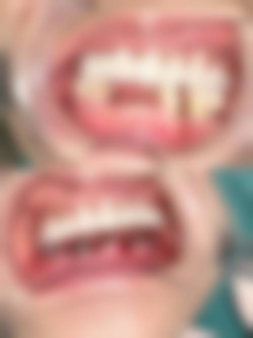 【北京雅逸口腔门诊部参考价格表】