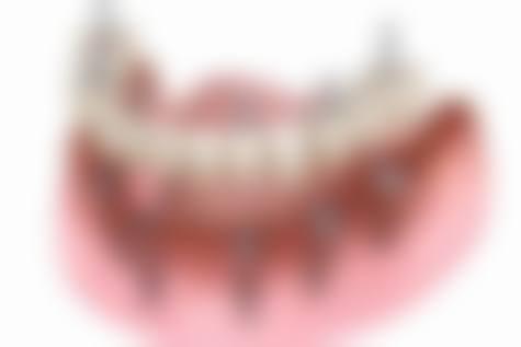 【江苏盐城张中瑶口腔门诊部骨干医生团队与技术标准】