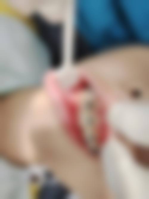 【江苏盐城张中瑶口腔门诊部参考价格表】