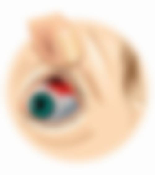 临床实例分享