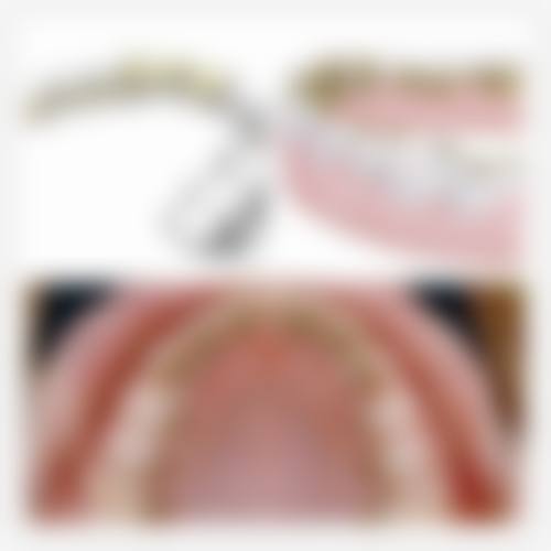 【广西 南宁蔻齿口腔真实口碑评价】