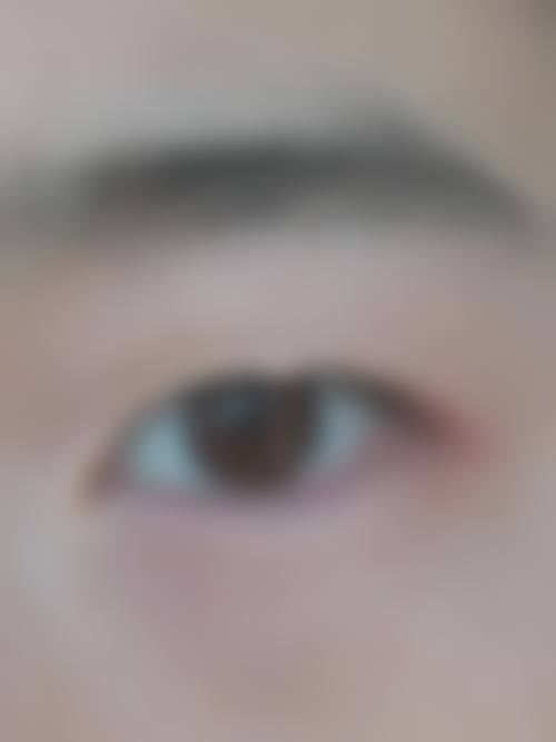 特色科室与诊疗项目——精细检测,覆盖全眼病
