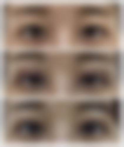 六、石河子名壹美整形医院口碑怎么样？听听顾客的真实反馈