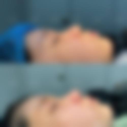 三、石河子名壹美整形医院有哪些项目？满足不同需求的多元选择