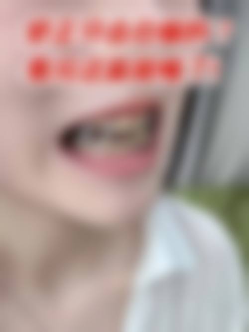 【上饶市广信区美维阳光口腔门诊有限公司参考价格表】