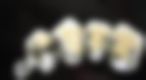 【杭州名一口腔门诊部(滨江区伟业路)参考价格表】