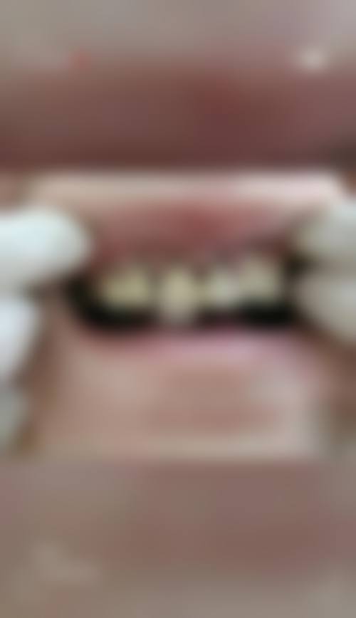 【湖南永州宁远正骨医院口腔科前列技术设备与院感环境】