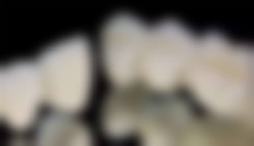 术前术后服务流程解析:全程无忧的贴心关怀