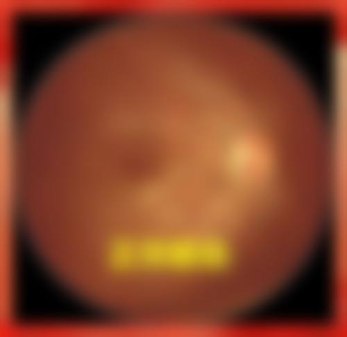 西安蕴瞳眼科诊所正规吗?资质与专精背景让您放心