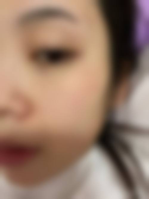 优惠活动详情:原价与优惠价对照,限时体验高品质医美