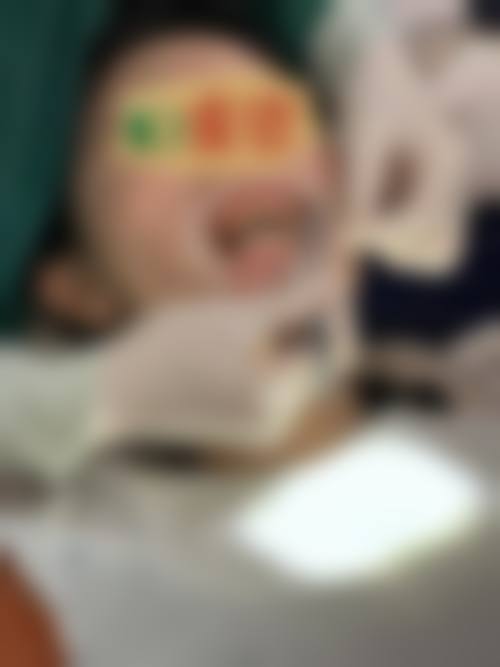 临床实例分享