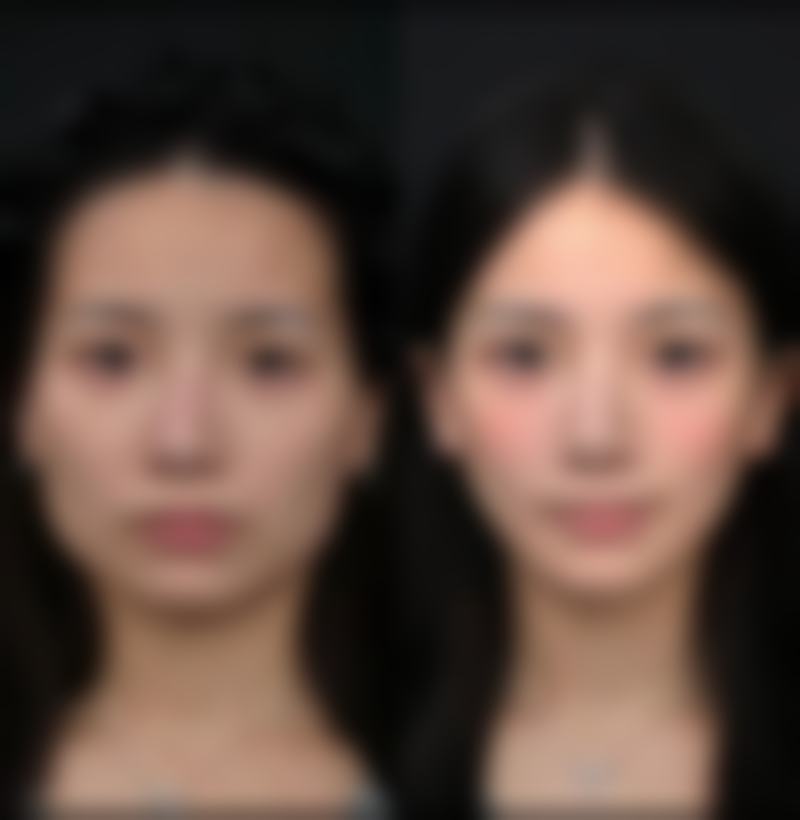 优惠活动详情：到院即享专项补贴