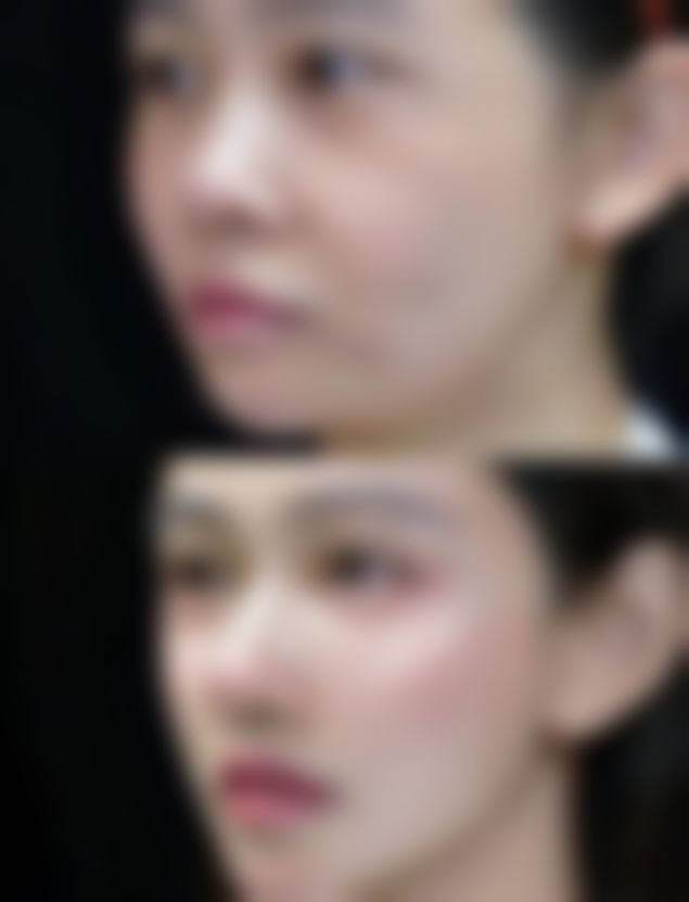 新疆创美阁整形医疗美容诊所2026年收费价格参考(部分项目)