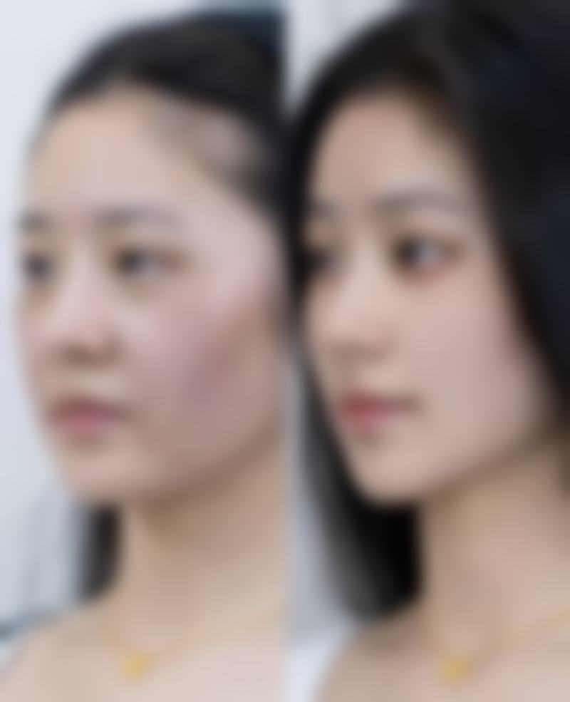 新疆创美阁整形医疗美容诊所擅长哪些项目?能解决什么变得更美需求?